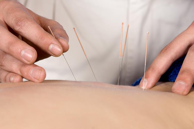 Acupuncture Denver, CO 